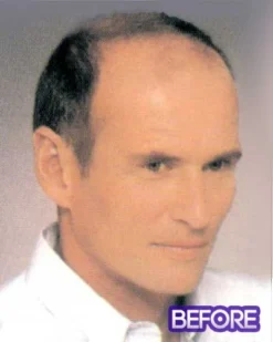 Conrad | Men's Hairpiece By Leading Man Toupee For Men