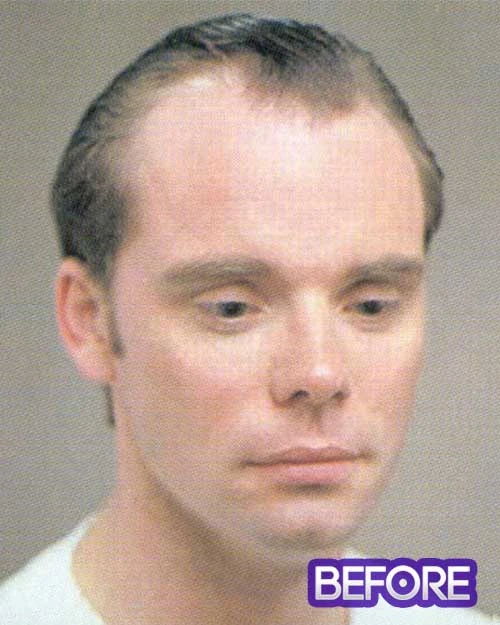 Toupee For Men Adam | Men's Hairpiece By Leading Man 5 Toupee For Men Adam | Men's Hairpiece By Leading Man