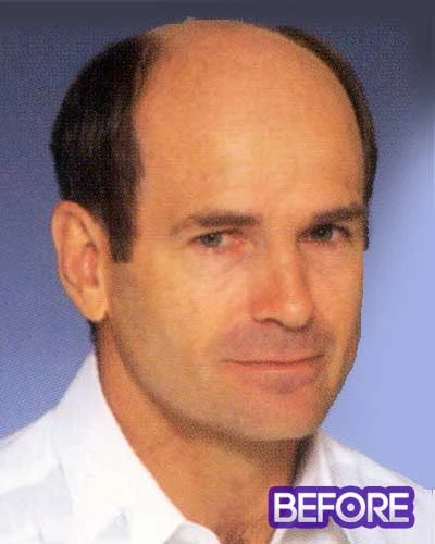 Ready To Wear | Men's Hairpiece By Leading Man Toupee For Men 5 Ready To Wear | Men's Hairpiece By Leading Man Toupee For Men