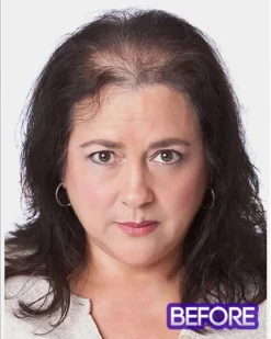 Total Topper HF | Synthetic Wiglet By Toni Brattin